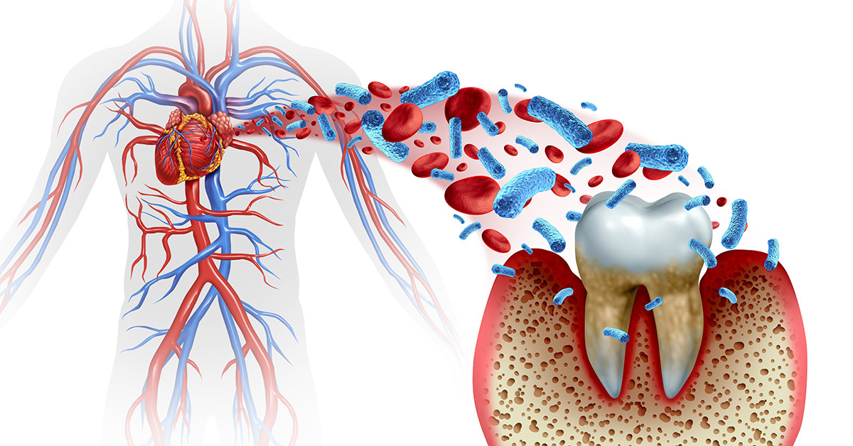 Relationship between heart and oral health